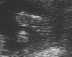 foot.jpg (8568 bytes)